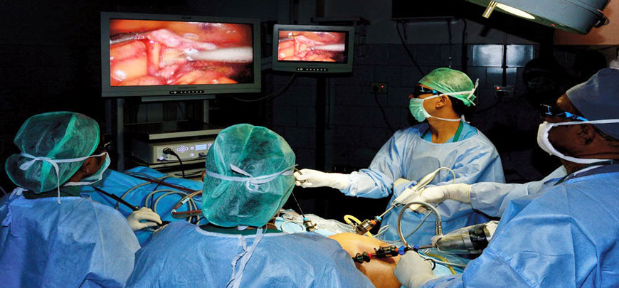 Laparoscopy